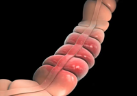 【健康科普】武寧縣人民醫院體檢（jiǎn）保健科：吃飯有（yǒu）這3個習慣，可能（néng）會被癌（ái）症“盯上”！