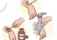 【急診第（dì）一線】武寧縣人民醫院急診科成功救（jiù）治一名毒蛇咬傷患者