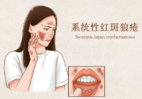 【健康（kāng）科普】武寧縣（xiàn）總醫院人民醫（yī）院院區內五科：帶您了（le）解係統性紅斑狼瘡，不再（zài）談“狼”色變