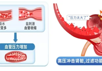 【世界腎髒日】武（wǔ）寧縣總醫院人民醫院院區腎內風濕（shī）內分泌科：您（nín）的腎（shèn）髒健康嗎？早檢查，保健康（kāng）