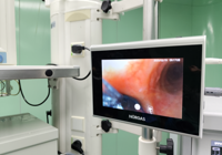 【新技術】武寧縣總醫院人民醫院院區手術（shù）麻醉科：可視雙腔支氣管插管，精（jīng）準麻醉護航微創手術