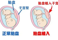 【多險疊加孕途艱 妙手仁心護周全】武寧縣總醫院人民醫院院區成功救治高危胎盤植入（rù）產婦（fù）